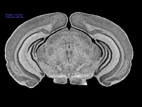 Mouse Brain Section
