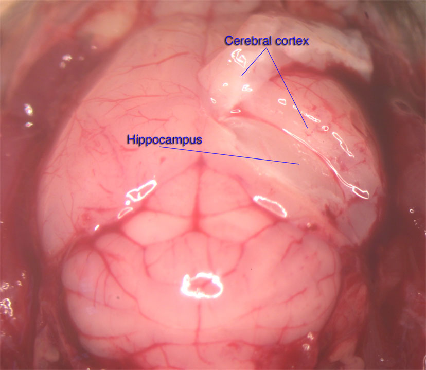 hippocampus anatomy mouse