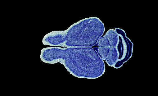 Mouse Brain Section