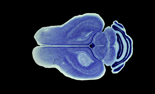 Mouse Brain Section