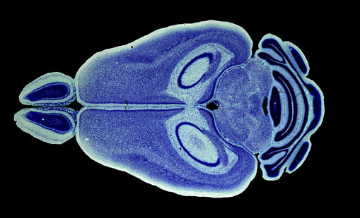 Mouse Brain Section