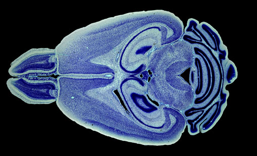 Mouse Brain Section