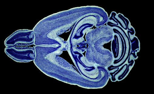 Mouse Brain Section