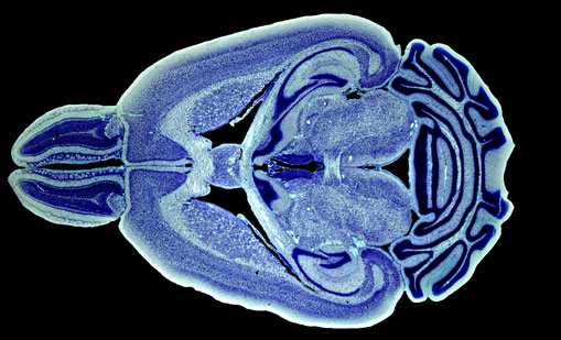 Mouse Brain Section