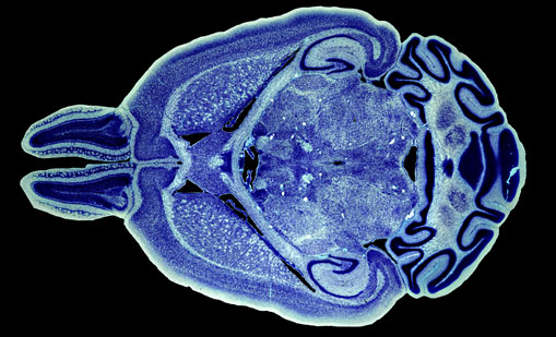 Mouse Brain Section