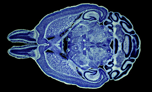 Mouse Brain Section