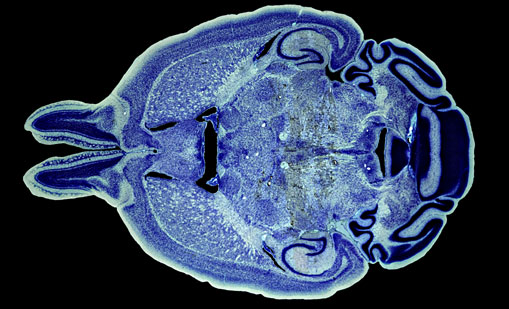 Mouse Brain Section