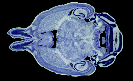 Mouse Brain Section