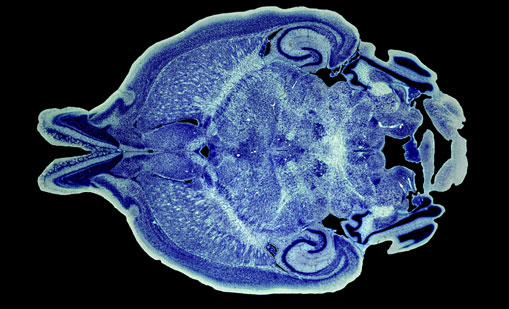 Mouse Brain Section