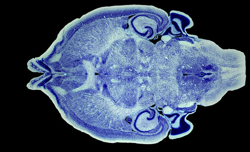 Mouse Brain Section