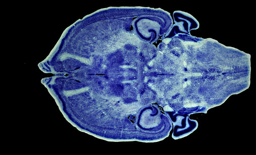 Mouse Brain Section