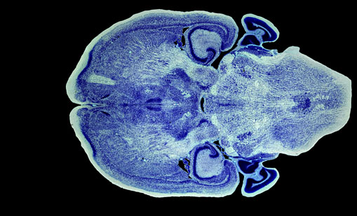 Mouse Brain Section