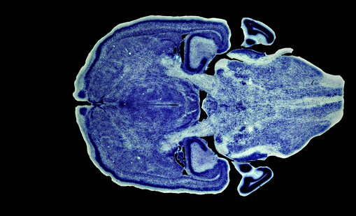 Mouse Brain Section