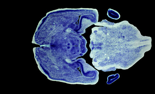 Mouse Brain Section