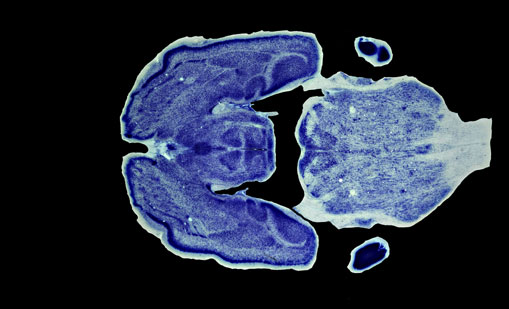 Mouse Brain Section