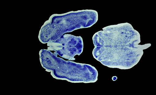 Mouse Brain Section