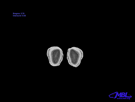 Mouse Brain Section