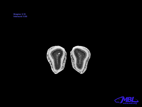 Mouse Brain Section