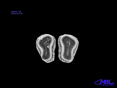 Mouse Brain Section