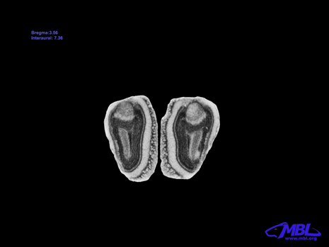 Mouse Brain Section