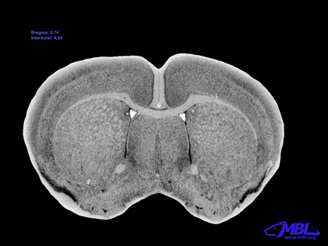 Mouse Brain Section