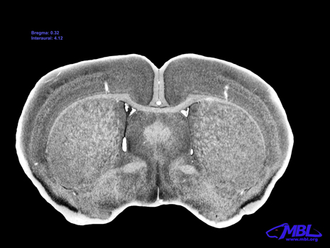 Mouse Brain Section