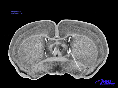 Mouse Brain Section