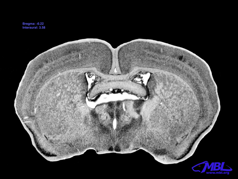 Mouse Brain Section