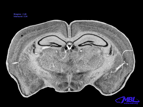 Mouse Brain Section