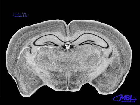 Mouse Brain Section
