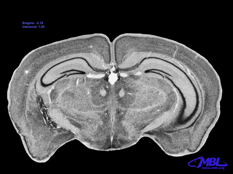 Mouse Brain Section