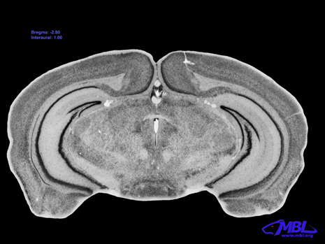 Mouse Brain Section