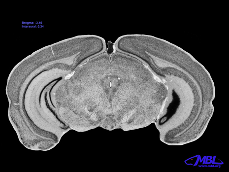 Mouse Brain Section