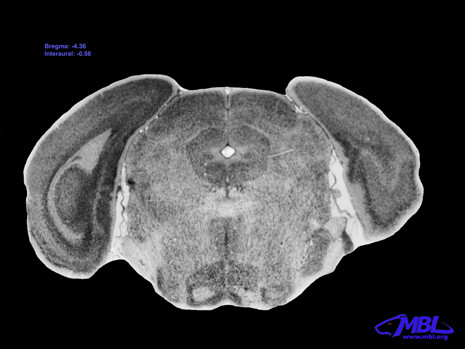 Mouse Brain Section