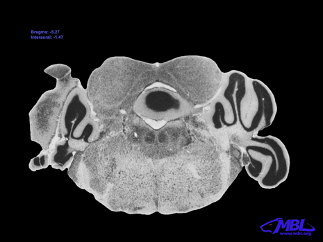 Mouse Brain Section