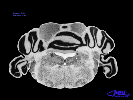 Mouse Brain Section