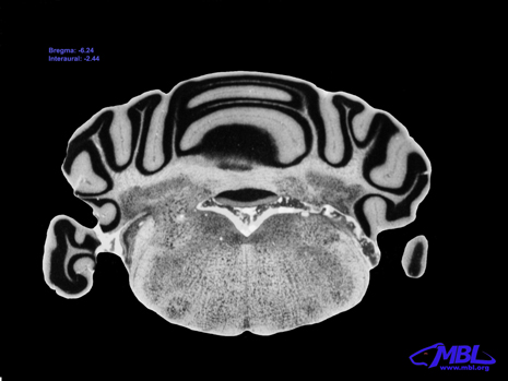 Mouse Brain Section