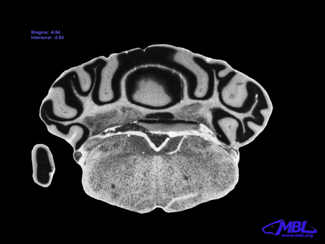 Mouse Brain Section
