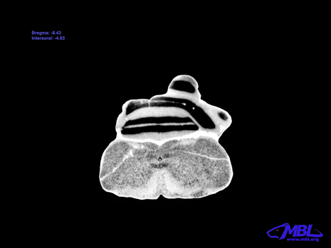 Mouse Brain Section