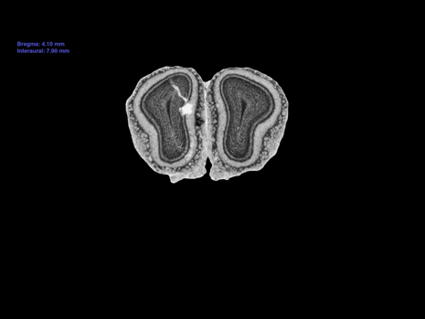 Mouse Brain Section