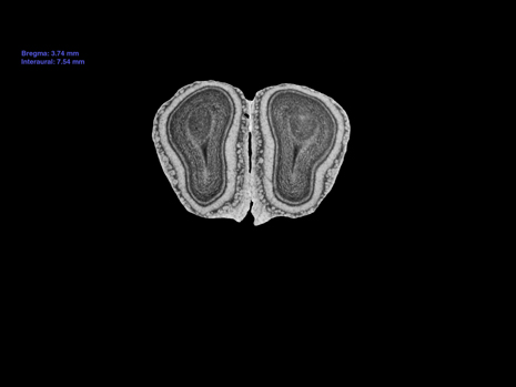 Mouse Brain Section