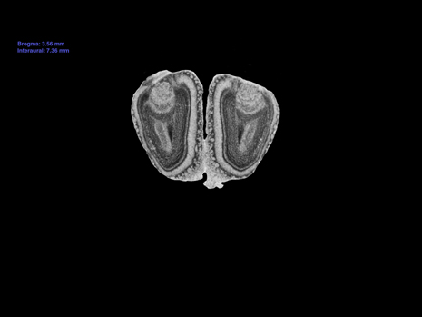 Mouse Brain Section