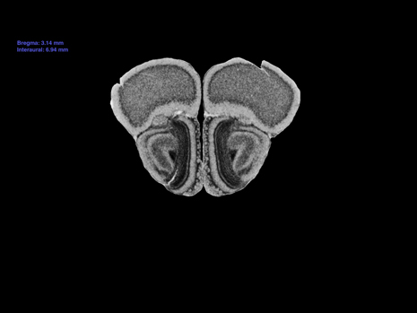 Mouse Brain Section