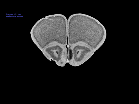 Mouse Brain Section