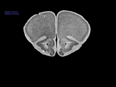 Mouse Brain Section