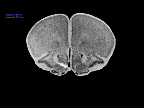 Mouse Brain Section