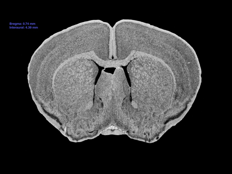 Mouse Brain Section