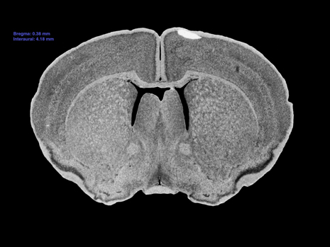 Mouse Brain Section