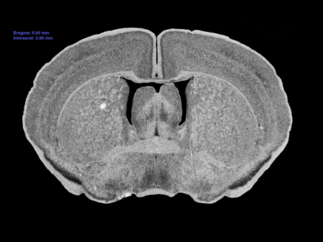 Mouse Brain Section