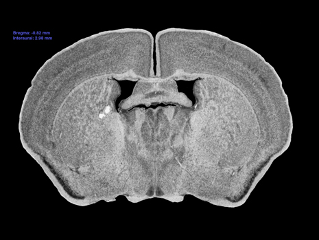 Mouse Brain Section